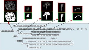 brainn interactive max tree
