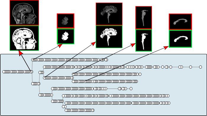 brainn interactive max tree