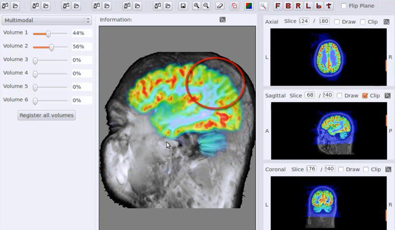 brainn software analise cerebral professora ting
