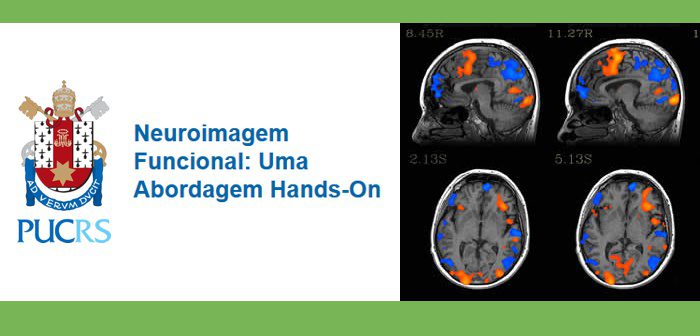 curso neuroimagem abordagem funcional