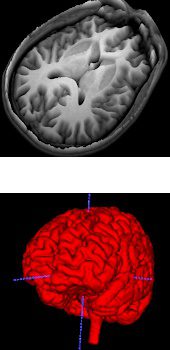 brainhack - imagens cerebrais