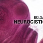 CEPID BRAINN - Bolsa pos-doc neurocisticercose