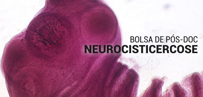 CEPID BRAINN - Bolsa pos-doc neurocisticercose