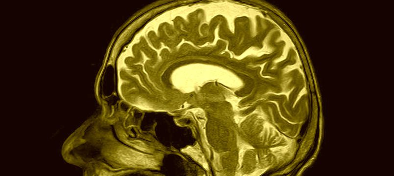 CEPID BRAINN - MRI do cerebro