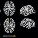 CEPID BRAINN - Divulgacao Agencia FAPESP - efeitos da covid-19 no cerebro