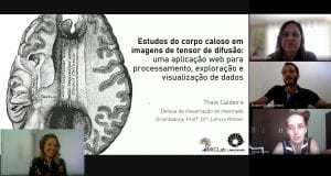CEPID BRAINN - Corpus callosum studies in diffusion MRI - imagem da Defesa