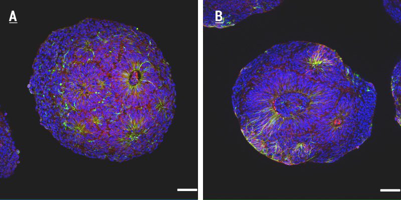 CEPID BRAINN - Imunomarcacao de tubulina e N-caderina na regiao proliferativa dos organoides corticais 2