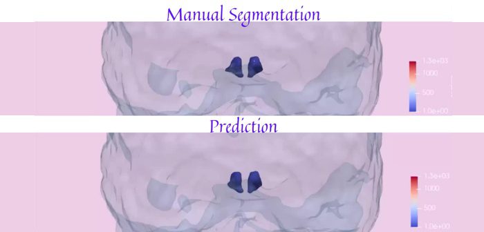 Paper published in ‘Neuroimage’ let´s you download hypothalamus imaging data and participate in segmentation competition