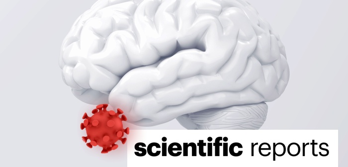 Pesquisadores do BRAINN publicam, na Scientific Reports, análise sobre impacto cognitivo e cerebral da COVID-19